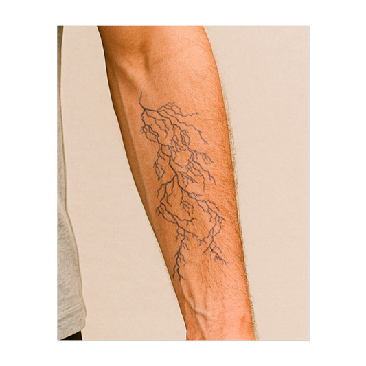 Arbre de foudre